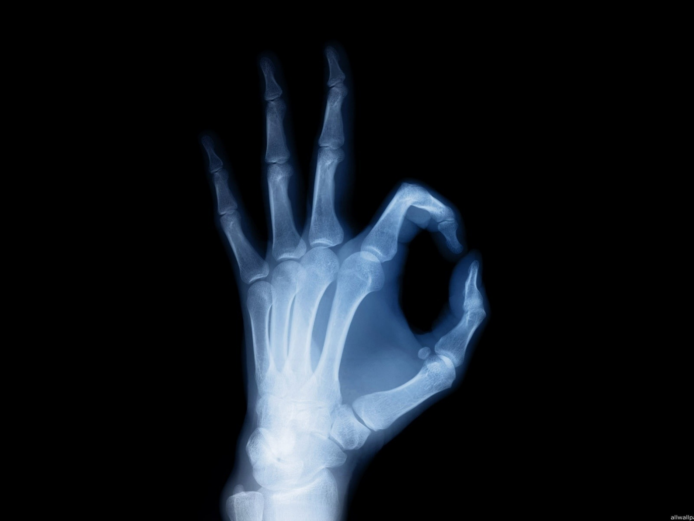 рентген, ок, кости, скелет, рука