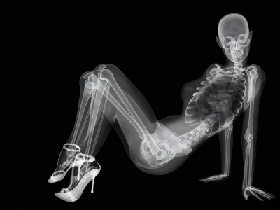 девушка, рентген, черный фон, скелет