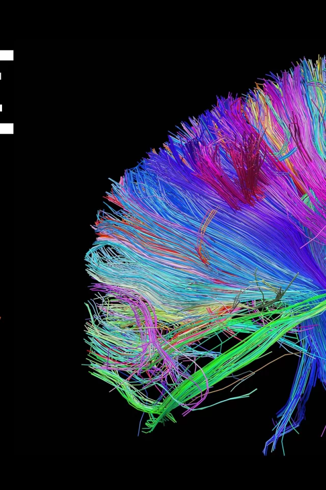 brain, colors, wires, Muse, the 2nd law, обложка, bundle