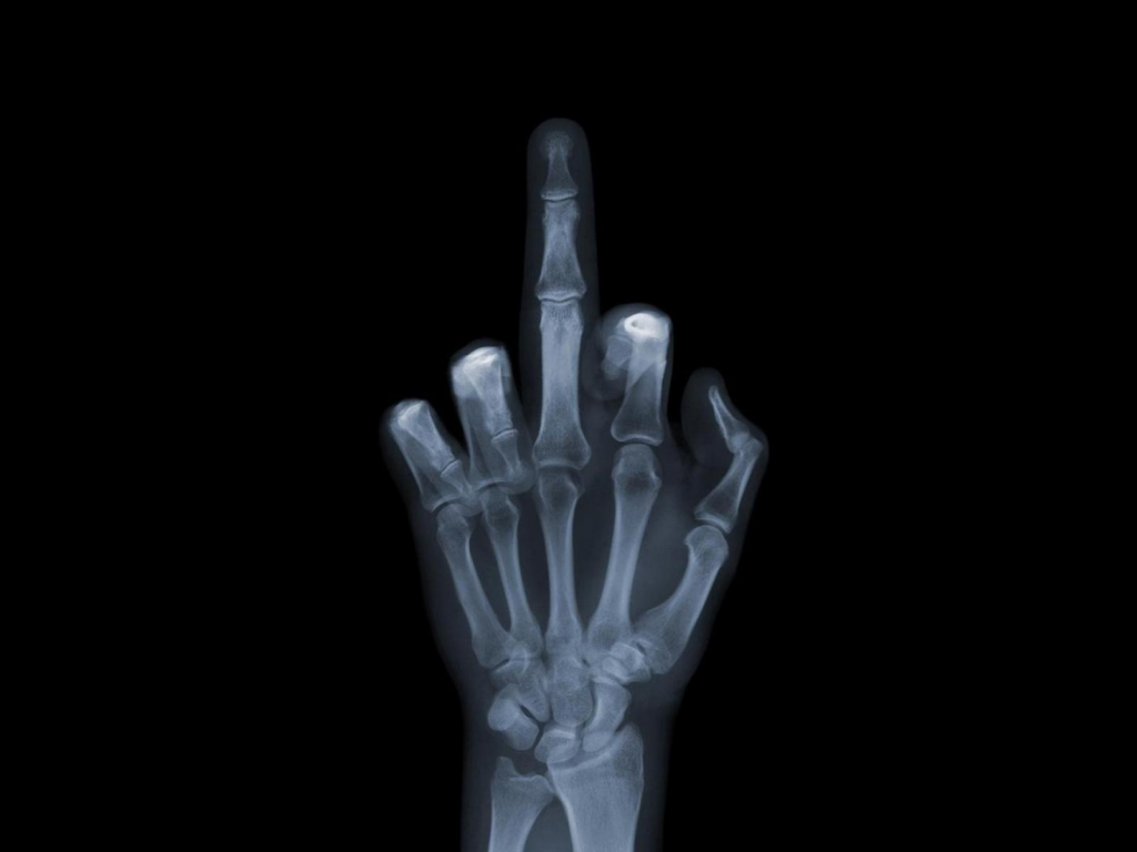 рентген, кисть, палец